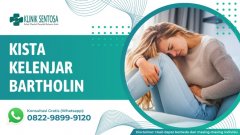 Kista Kelenjar Bartholin