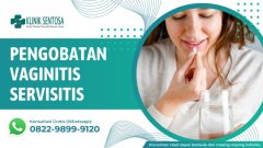 Pengobatan Vaginitis Servisitis