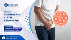 Ada Benjolan Di Atas Kelamin Pria